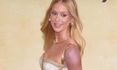 Perrengue chique Marina Ruy Barbosa explica braco roxo em Cannes