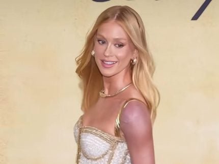 Perrengue chique Marina Ruy Barbosa explica braco roxo em Cannes