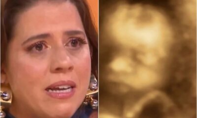 Por que Tati Machado precisou passar pelo trabalho de parto