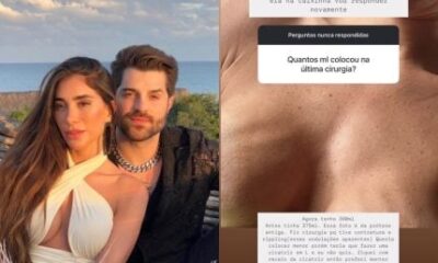 Romana Novais mostra ondulacoes nos seios apos complicacoes com protese