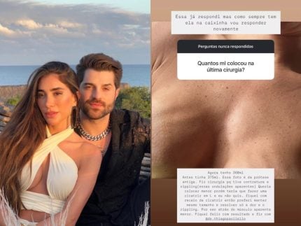Romana Novais mostra “ondulações” nos seios após complicações com prótese de silicone 31 Romana Novais mostra ondulacoes nos seios apos complicacoes com protese