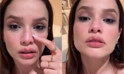 Video mostra situacao de Juliette apos quebrar o nariz ‘Ta
