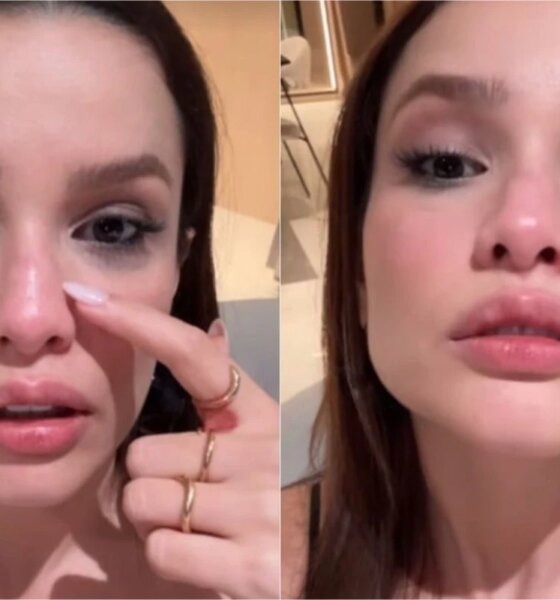 Video mostra situacao de Juliette apos quebrar o nariz ‘Ta