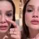 Video mostra situacao de Juliette apos quebrar o nariz ‘Ta