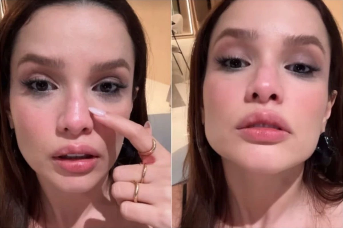 Vídeo mostra situação de Juliette após quebrar o nariz: ‘Tá meio torto’, desabafou a ex-BBB 30 Video mostra situacao de Juliette apos quebrar o nariz ‘Ta