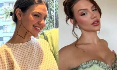Vivi Wanderley passa por nova recauchutada pos lipo e opera os
