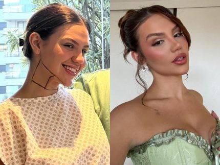 Vivi Wanderley passa por nova recauchutada pós-lipo e opera os seios 31 Vivi Wanderley passa por nova recauchutada pos lipo e opera os