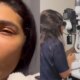 ‘Me cuidar e ficar em observacao diz Pocah apos acidente
