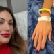‘Reajo quando coloco batom vermelho Patricia Poeta fala sobre recuperacao