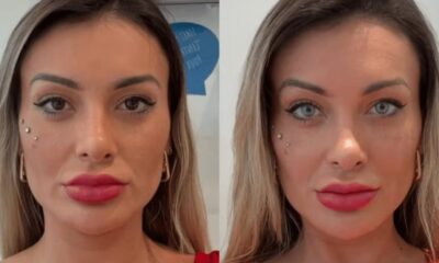 Andressa Urach relata desespero e pede oracoes apos complicacoes do