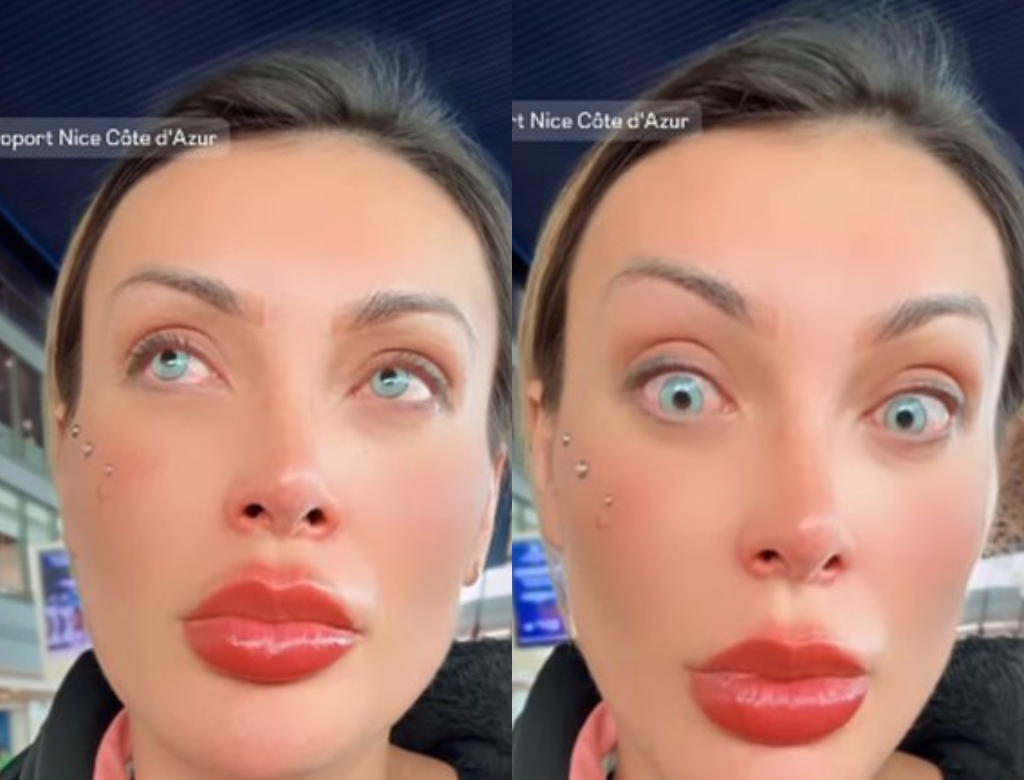 Andressa Urach relata dor intensa após mudar a cor dos olhos na França: “Arrependida” 37 Andressa Urach (foto Reprodução Redes Sociais)