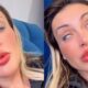 Andressa Urach relata piora e complicacao apos cirurgia estetica nos