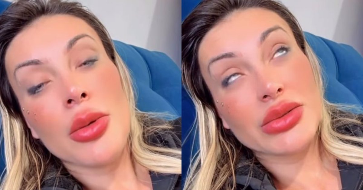 Andressa Urach relata piora e complicação após cirurgia estética nos olhos 31 Andressa Urach relata piora e complicacao apos cirurgia estetica nos