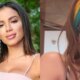 Anitta surge com rosto irreconhecivel apos periodo de recuperacao