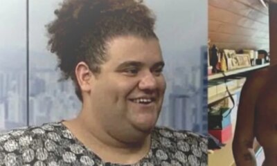 Antes e depois de Gominho 53 kg a menos nova