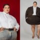 Apos perder 30 kg e passar por cirurgia bariatrica Thais