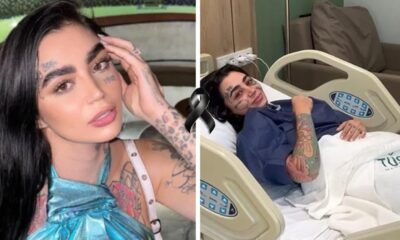 Cantora brasileira nao resiste apos fazer varias cirurgias plasticas e
