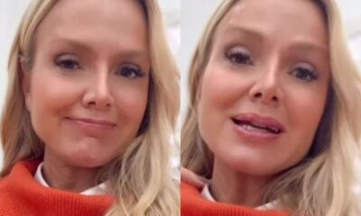Capsulite adesiva Eliana relembra drama e faz alerta sobre os