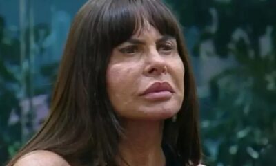 Em video Gretchen ironiza resultado de novo procedimento estetico no