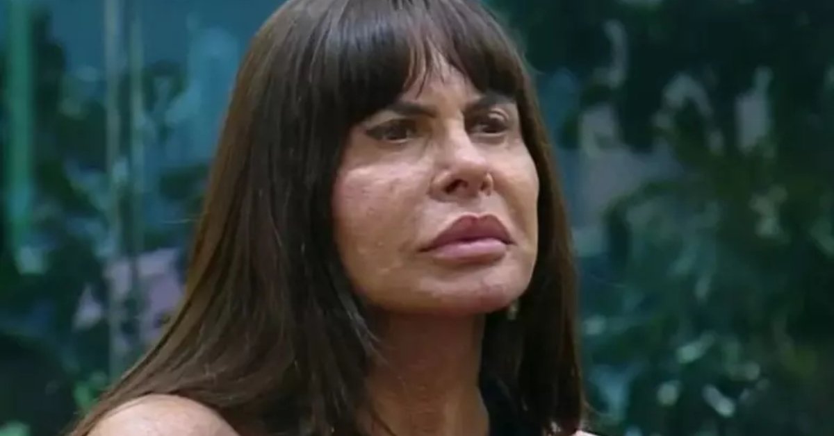 Em vídeo, Gretchen ironiza resultado de novo procedimento estético no rosto após ser acusada de uso excessivo de filtro 31 Em video Gretchen ironiza resultado de novo procedimento estetico no