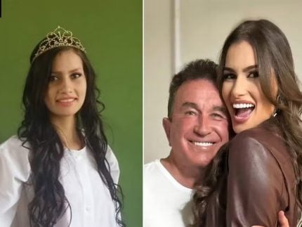Esposa de Amado Batista revela se ja fez plasticas apos
