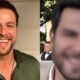 Ex BBB Gustavo Marsengo mostra resultado de harmonizacao facial e web