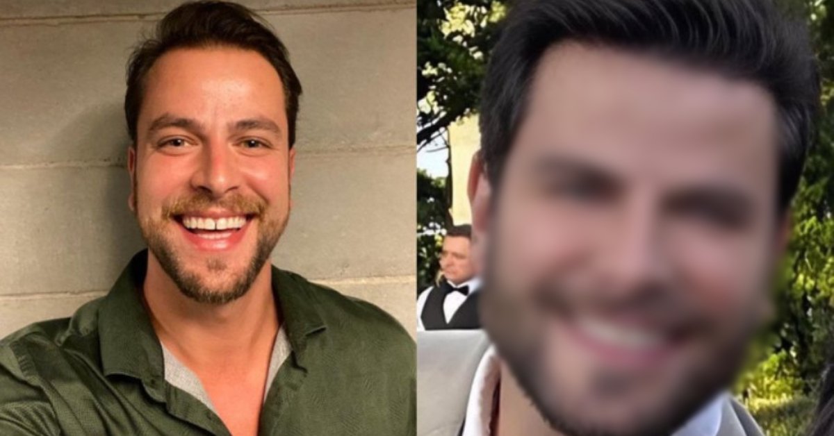 Ex-BBB Gustavo Marsengo mostra resultado de harmonização facial e web reage: 'trocou de cabeça' 31 Ex BBB Gustavo Marsengo mostra resultado de harmonizacao facial e web