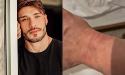 Ex Fazenda Lucas Viana aparece ferido e diz ter sido detido