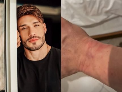 Ex-Fazenda Lucas Viana aparece ferido e diz ter sido detido em Dubai: “Orem por mim” 31 Ex Fazenda Lucas Viana aparece ferido e diz ter sido detido