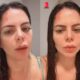 Gravida ex Casamento as Cegas sofre grave acidente e exibe queimaduras