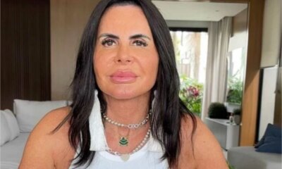 Gretchen passa por nova harmonizacao e exibe resultado real nas