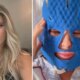 Iris Stefanelli surge inchada apos lifting facial e exibe inicio