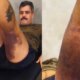 Juliano Cazarre inicia reabilitacao apos cirurgia no joelho e queda