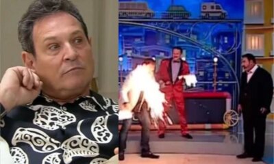 Luis Ricardo revela que quando queimou o rosto no Ratinho