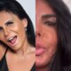 Sem filtro Gretchen surge de cara lavada e mostra resultado