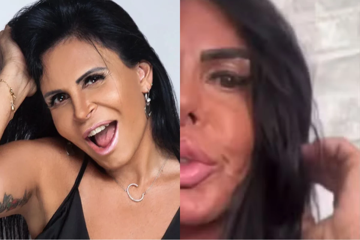 Sem filtro! Gretchen surge de cara lavada e mostra resultado de novos procedimentos estéticos 33 Sem filtro Gretchen surge de cara lavada e mostra resultado