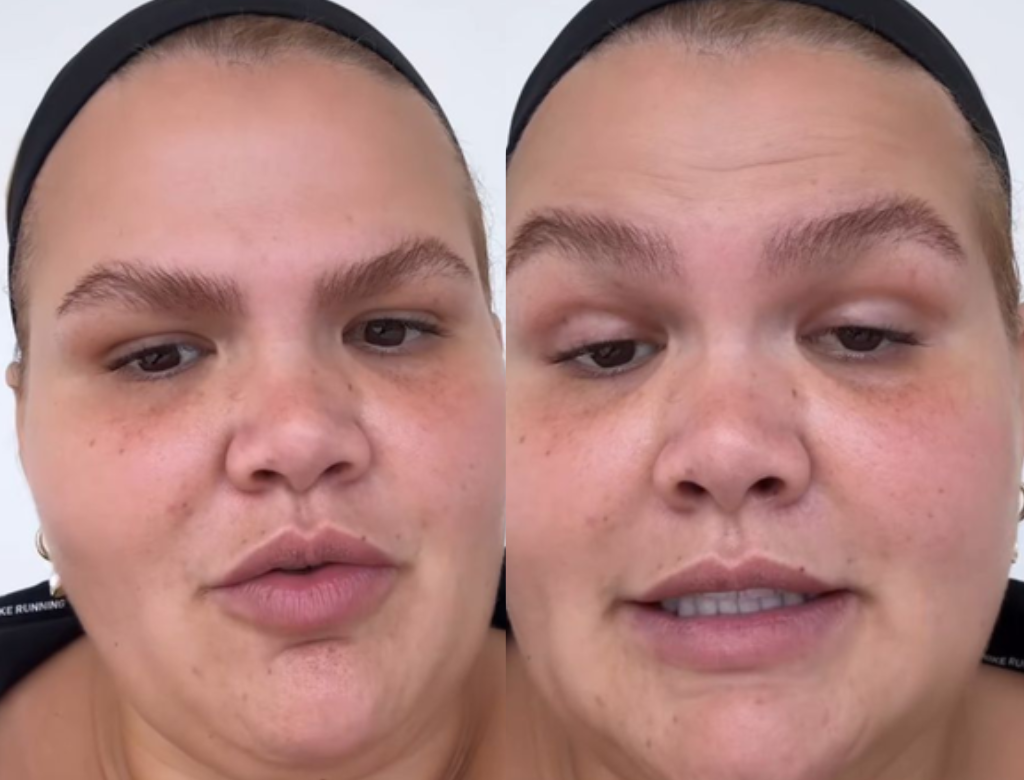 Thais Carla revela que bariátrica prejudicou outro problema de saúde 37 Thais Carla (foto Reprodução Redes Sociais)
