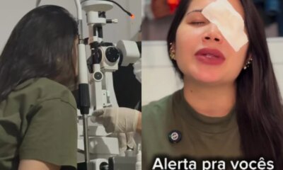 Trend quase custou a visao influenciadora tem problema nos olhos