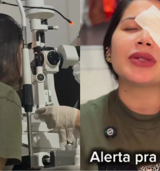 Trend quase custou a visao influenciadora tem problema nos olhos