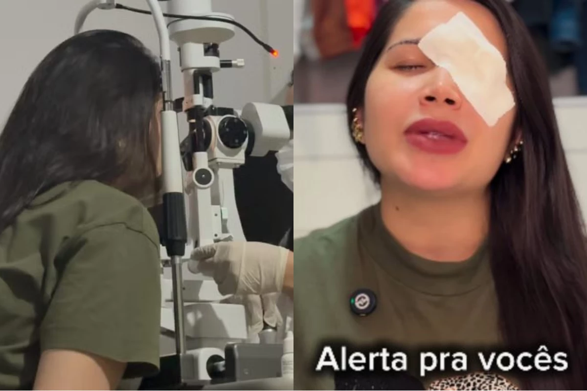 Trend quase custou a visão: influenciadora tem problema nos olhos e faz alerta urgente aos seguidores 33 Trend quase custou a visao influenciadora tem problema nos olhos