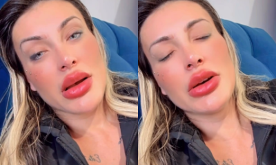 Urach desabafa que ainda esta com dor apos mudar cor
