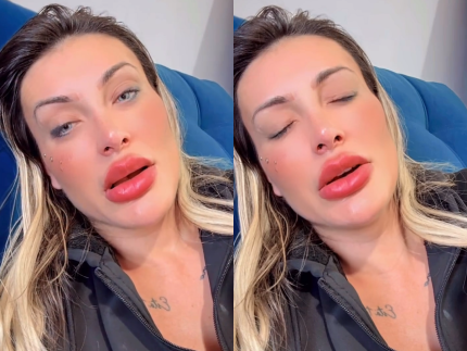 Urach desabafa que ainda está com dor após mudar cor dos olhos: “Medo de ficar cega” 31 Urach desabafa que ainda esta com dor apos mudar cor