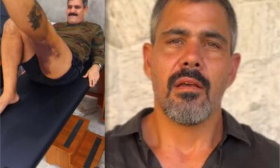 Video Juliano Cazarre mostra hematomas apos ser submetido a uma