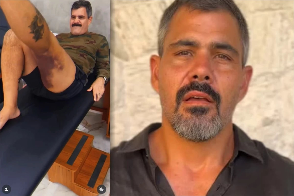 Vídeo: Juliano Cazarré mostra hematomas após ser submetido a uma cirurgia; ele está em recuperação 31 Video Juliano Cazarre mostra hematomas apos ser submetido a uma
