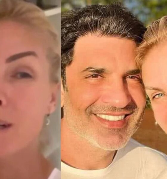 Ana Hickmann confirma cirurgia as pressas em Edu Guedes apos