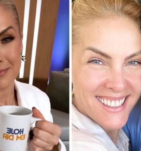Ana Hickmann traz atualizacao sobre Edu Guedes apos cirurgia