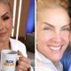 Ana Hickmann traz atualizacao sobre Edu Guedes apos cirurgia