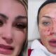 Andressa Urach volta a assustar seguidores ao surgir com o