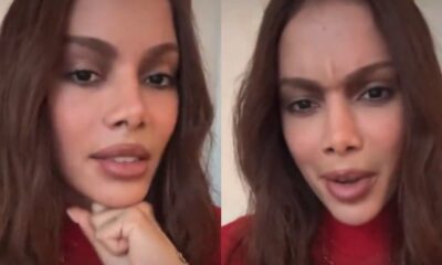Anitta abre o jogo sobre procedimentos esteticos e revela que