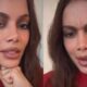 Anitta abre o jogo sobre procedimentos esteticos e revela que
